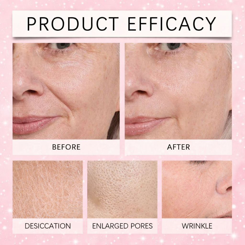 Her Renewal Micro Needling